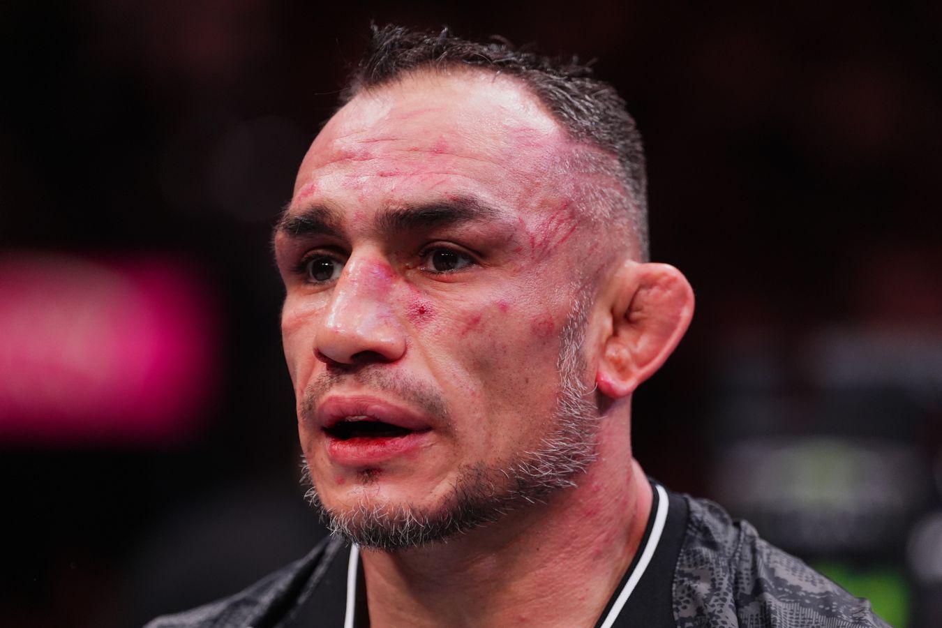 Ferguson Reveals His Toughest Career Fight – Its Not Gaethje, Its Jardine